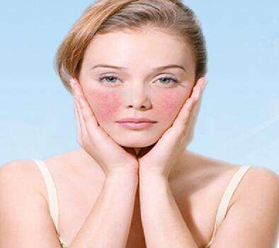 脸部过敏怎么办